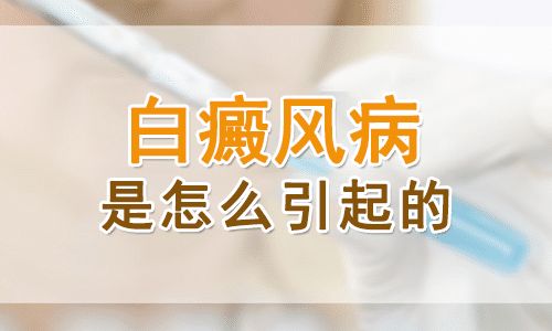 白癜风的发病因素都有哪些